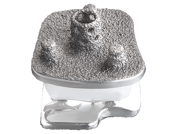 Vantage Total Ankle System tibia’s press-fit bone cage and plasma pegs