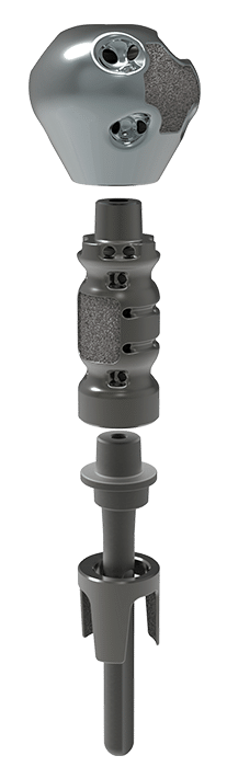 Equinoxe Humeral Reconstruction Prosthesis Midsections