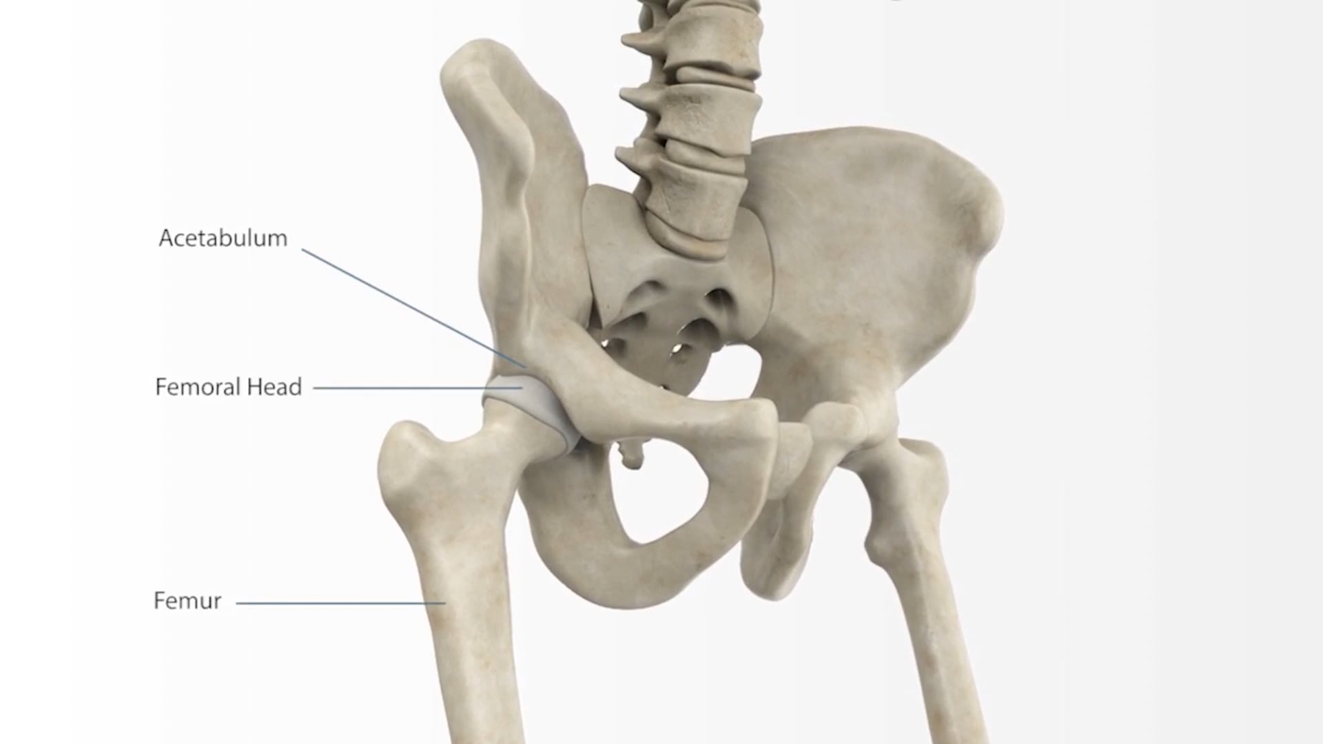 Understanding Total Hip Replacement Patient Animation